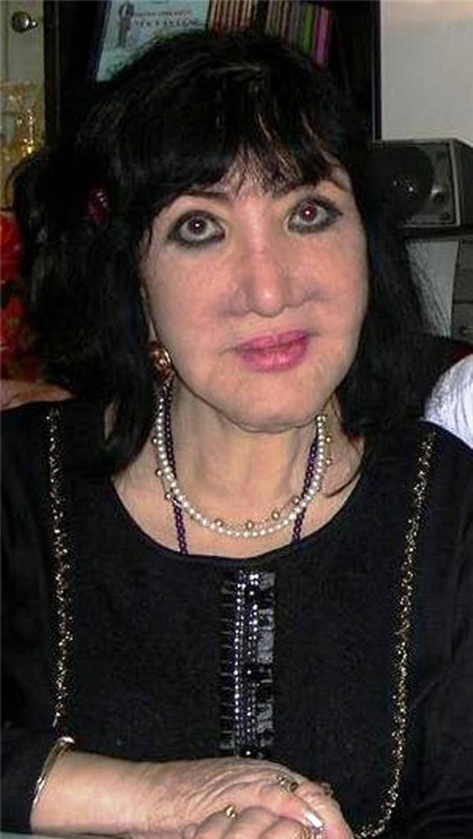 Ảnh: Trước Lệ Quyên, nhiều sao Việt gặp sự cố nhan sắc vì dao kéo-16