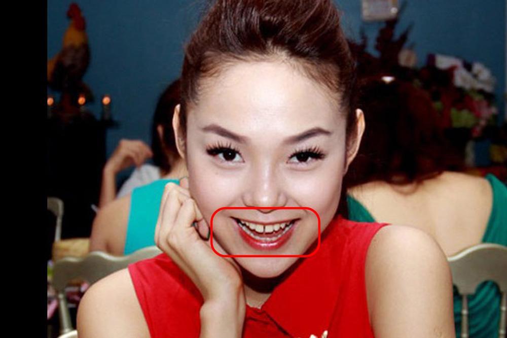 Đẹp như sao Việt cũng có lúc lộ cả dàn khuyết điểm như thế này-6