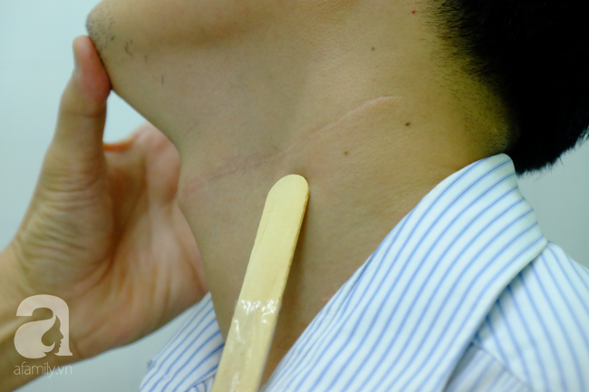 Thầy giáo trẻ phát hiện bị ung thư lưỡi trước đám cưới chỉ 20 ngày: Dấu hiệu nhận biết bệnh dễ bị bỏ qua-3