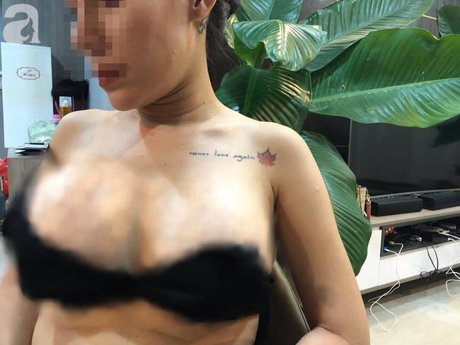 Em kết nghĩa của ca sĩ Quách Tuấn Du bị vỡ túi ngực 2.000 USD trên máy bay, bác sĩ thẩm mỹ biến mất-2