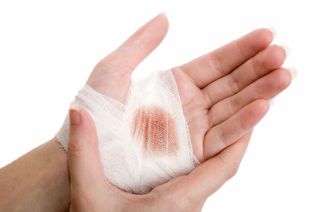 Cô gái bị đứt gân tay vì phần nguy hiểm trên cây lau nhà không phải ai cũng để ý-5