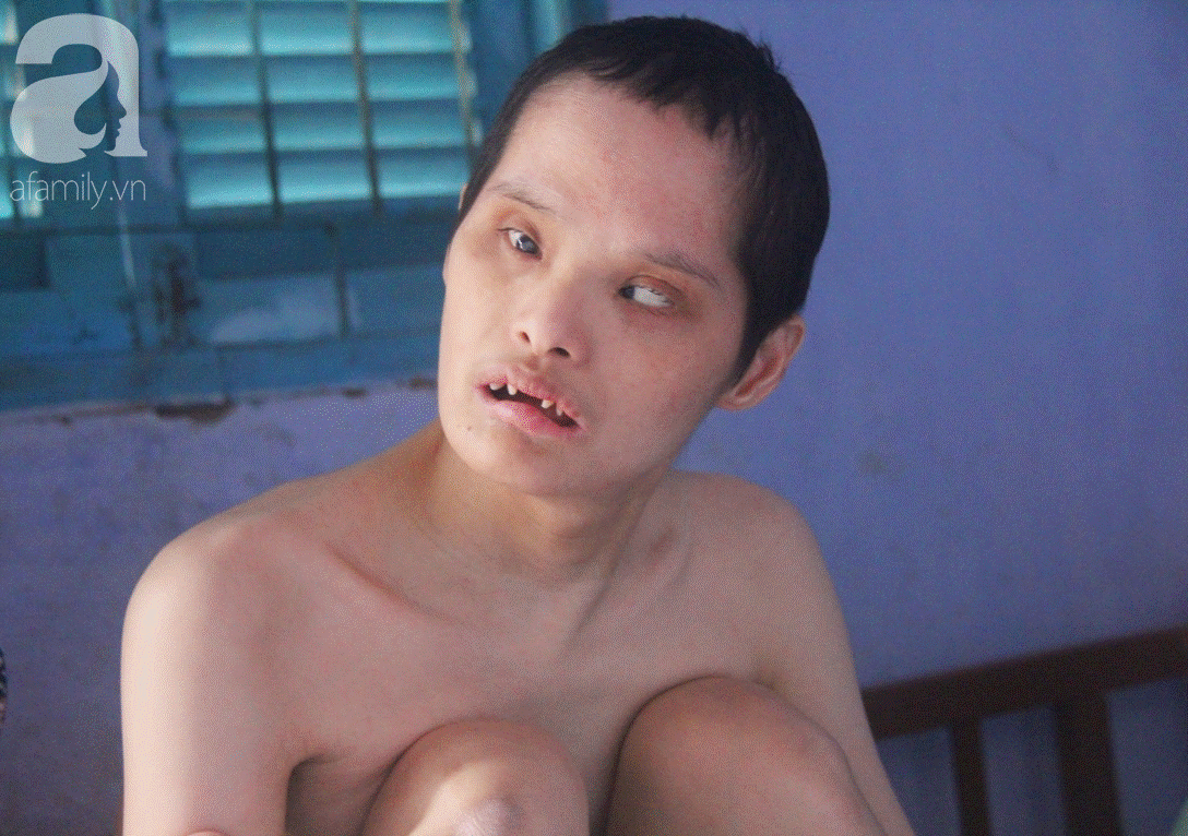 Rơi nước mắt cảnh mẹ già đi xin cơm từng bữa nuôi 2 con tâm thần cùng người chồng mù bệnh tật-4