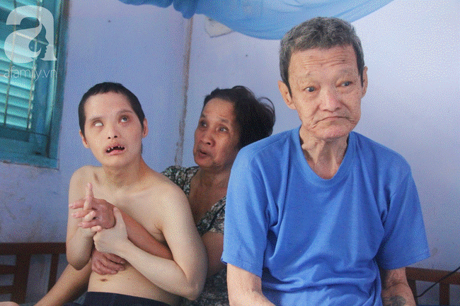 Rơi nước mắt cảnh mẹ già đi xin cơm từng bữa nuôi 2 con tâm thần cùng người chồng mù bệnh tật-8