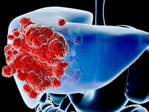 Thực phẩm sát thủ gây ung thư nhiều người Việt ăn hàng ngày-3