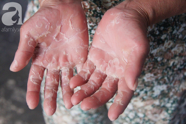 Rơi nước mắt cảnh mẹ già đi xin cơm từng bữa nuôi 2 con tâm thần cùng người chồng mù bệnh tật-11