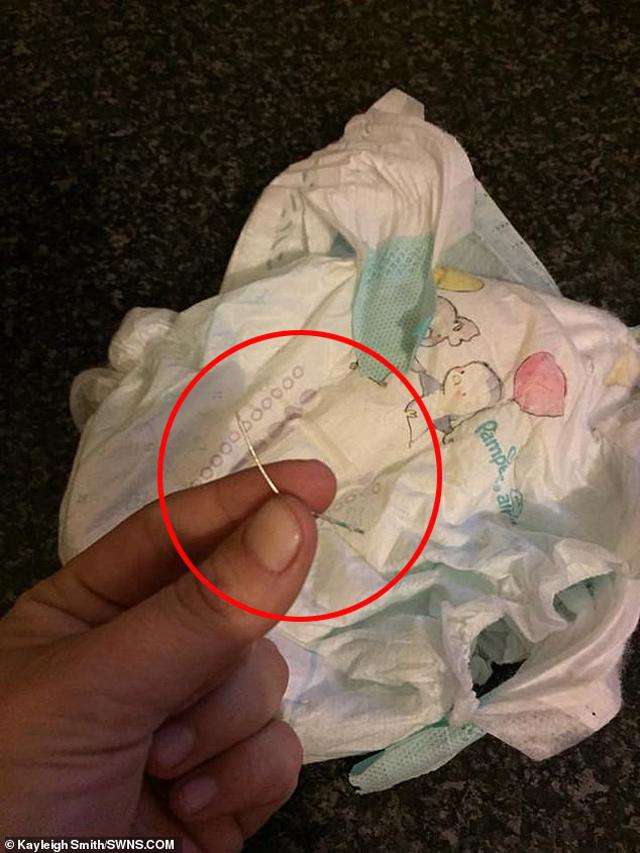 Thấy con trai tỏ vẻ khó chịu, mẹ tá hỏa phát hiện thứ kinh hoàng bên trong bỉm-3