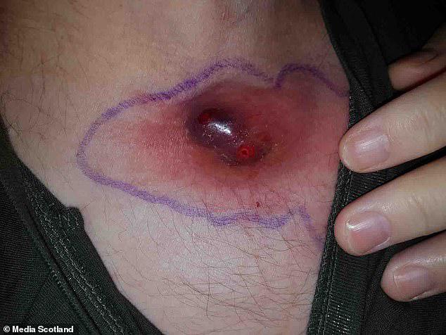 Thói quen tưởng hoàn toàn vô hại khiến người đàn ông suýt nhận án tử-4