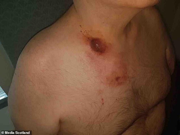 Thói quen tưởng hoàn toàn vô hại khiến người đàn ông suýt nhận án tử-3