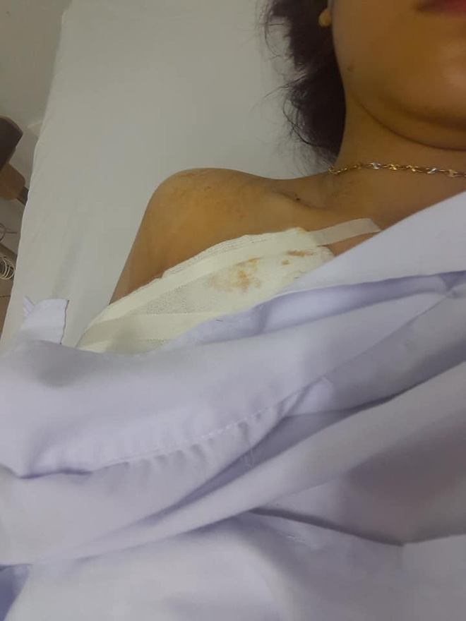 Xôn xao vụ cô gái xinh xắn bị cướp đâm trọng thương trước ngày đăng kí kết hôn-1