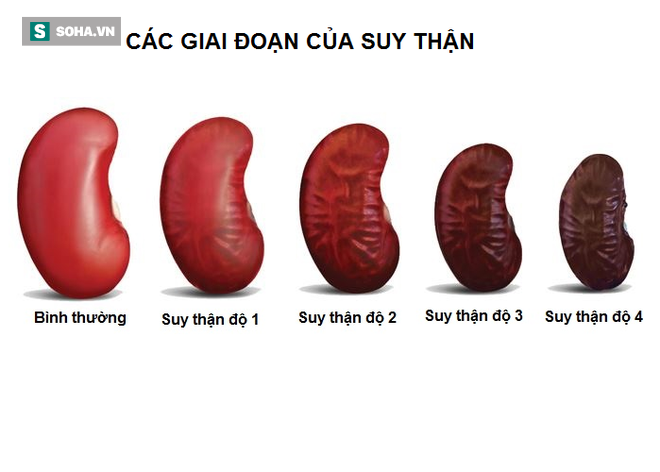 BS nêu nguyên nhân gây yếu thận và cách khắc phục bạn nên áp dụng sớm để không mất thận-2