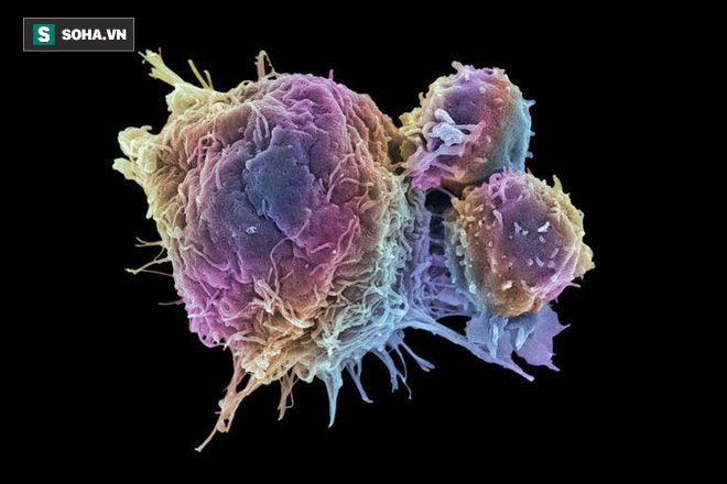 Mầm ung thư ẩn náu ở 7 loại thực phẩm: Nếu không muốn mắc bệnh, bạn nên đặc biệt chú ý!-1