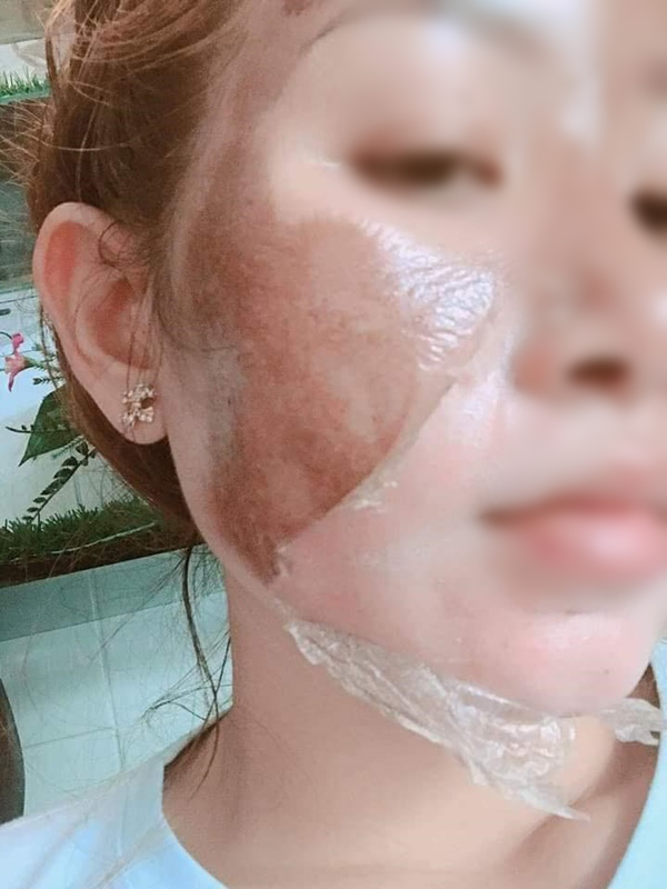 Góc cảnh báo: Cứ thích lăn kim, lột da nữa đi, bạn sẽ mất mặt như chơi đó!-2