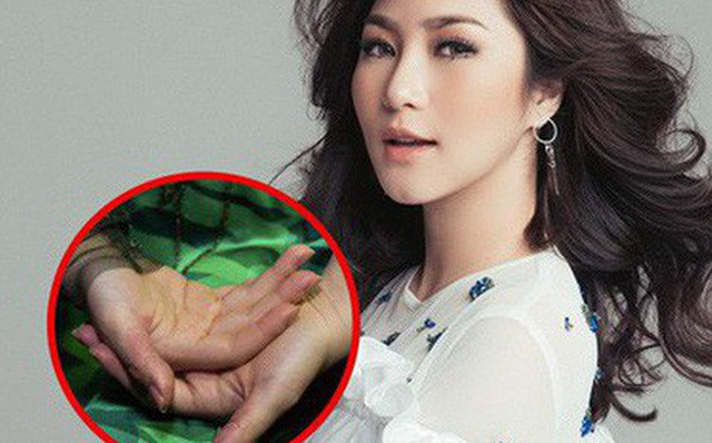 Hương Tràm stress tự bóc tay rỉ máu: Bác sĩ cảnh báo Hội chứng nguy hiểm gây chết người-1