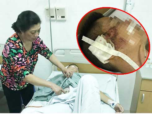 Bộ xương dưới gầm giường tố kẻ giết bạn chôn xác 7 năm-2