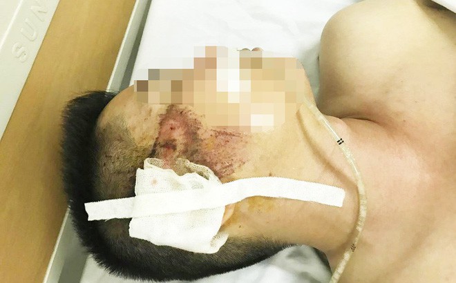 Vợ tài xế taxi sợ hãi kể lại giây phút chồng bị người ngồi trong xe Mazda bắn-1