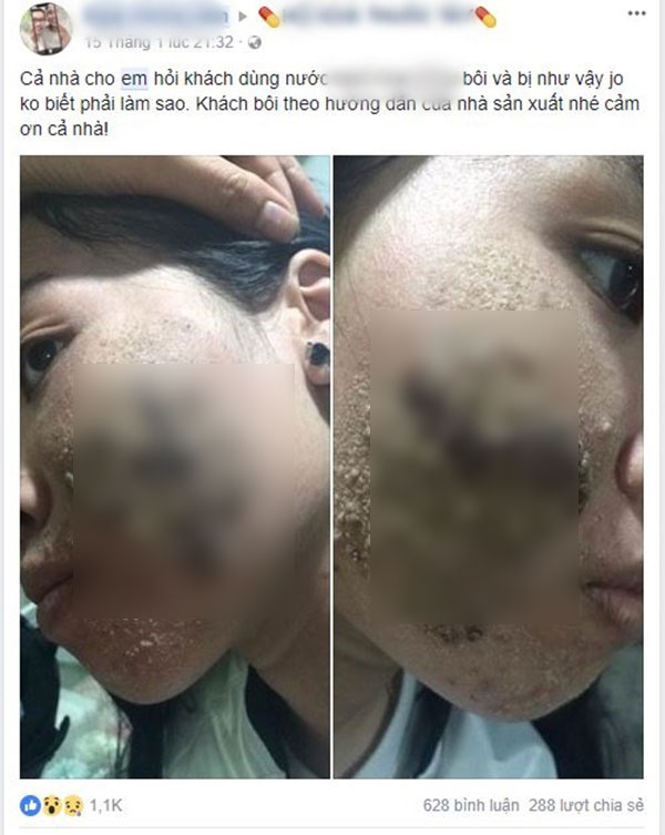 Góc cảnh báo: Cứ thích lăn kim, lột da nữa đi, bạn sẽ mất mặt như chơi đó!-1