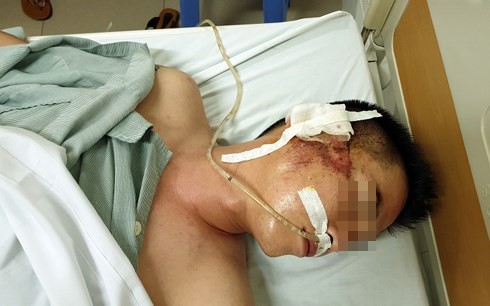 Đã tìm ra đối tượng lái xe Mazda CX5 bắn súng, chèn xe qua người lái taxi-3