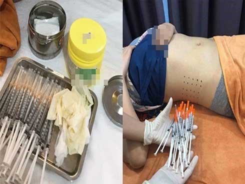 Sự thật đằng sau những ống tiêm tinh chất giảm cân đắt đỏ