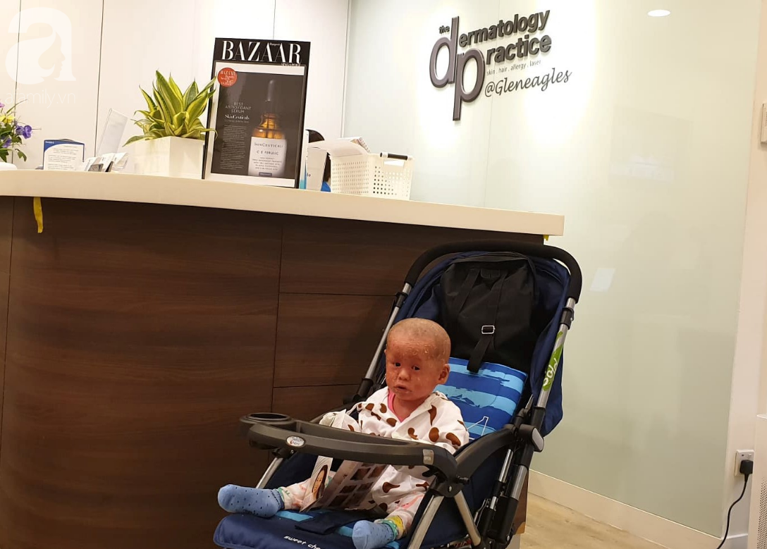 Hình ảnh mới nhất của bé Bích bị bỏ rơi, người đầy vẩy ngứa như da trăn sau đợt khám bệnh đầu tiên tại Singapore-1