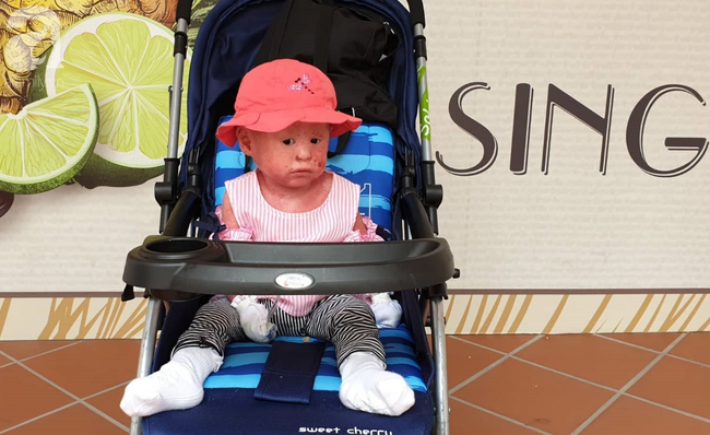 Hình ảnh mới nhất của bé Bích bị bỏ rơi, người đầy vẩy ngứa như da trăn sau đợt khám bệnh đầu tiên tại Singapore-9