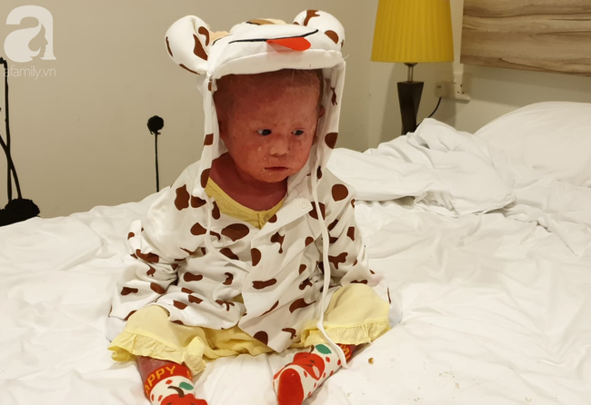 Hình ảnh mới nhất của bé Bích bị bỏ rơi, người đầy vẩy ngứa như da trăn sau đợt khám bệnh đầu tiên tại Singapore-10