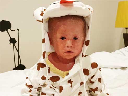 Bố nướng mực bằng cồn, con 2 tuổi tử vong, 3 người nguy kịch-2