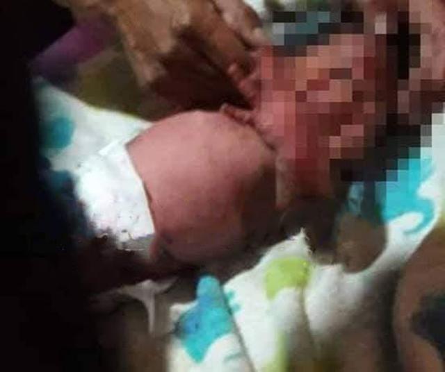 Nghe tiếng khóc kỳ lạ trong bể phốt, người phụ nữ sốc nặng với cảnh tượng bên dưới-2