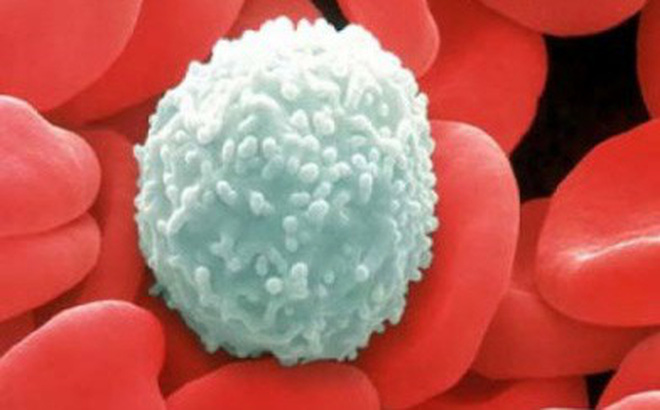 Hơn 165.000 người mắc mới năm 2018: Thực trạng ung thư ở Việt Nam có nghiêm trọng?-1