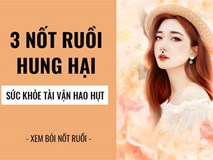 Ba nốt ruồi vô cùng nguy hại cho sức khỏe, tuyệt đối không nên giữ Ba nốt ruồi vô cùng nguy hại cho sức khỏe, tuyệt đối không nên giữ