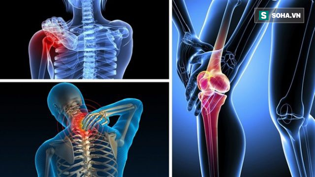 Đau cổ vai gáy lưng và xương khớp từ đầu đến chân: Chỉ cần tập 5 động tác này là sẽ đỡ hẳn-1