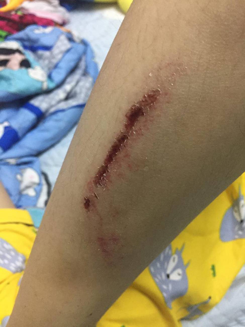 Hà Nội: Người phụ nữ đi xe máy bị 2 đối tượng áp sát đạp ngã sấp mặt xuống đường-2