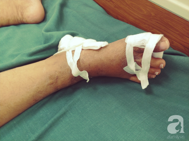 Bị vợ hờ” suy thận nặng, sắp mù lòa đuổi về, chồng vẫn quyết bám trụ chăm vợ đến hơi thở sau cùng-4