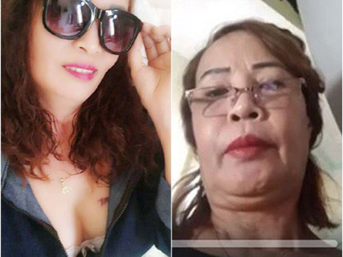 Sau khi căng da mặt, cô dâu 62 tuổi tiếp tục thể hiện sự chịu chơi khi chi hơn 200 triệu để làm răng-3