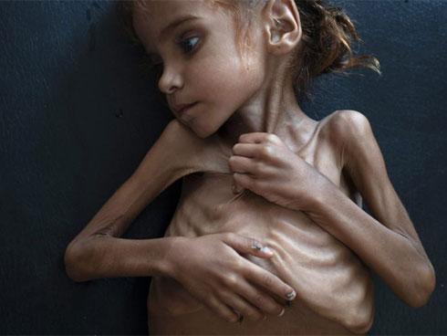 Bức ảnh cậu bé cõng em đã chết trên lưng và câu chuyện về khoảnh khắc khiến nhiếp ảnh gia ám ảnh suốt đời-5