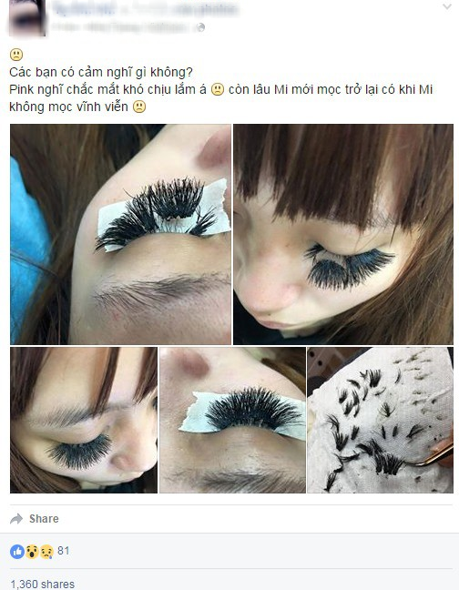 Tuyển tập những tai nạn đi nối mi nhưng chẳng thấy xinh, các cô gái trẻ trông như người ngoài hành tinh-5