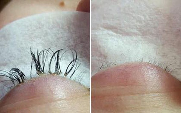 Tuyển tập những tai nạn đi nối mi nhưng chẳng thấy xinh, các cô gái trẻ trông như người ngoài hành tinh-6