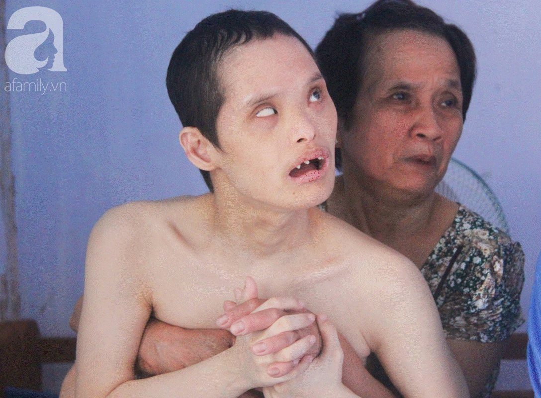 Người mẹ già nuôi 2 con tâm thần cùng chồng mù bật khóc: Tụi nhỏ được ăn cá thịt, nó mừng lắm-7