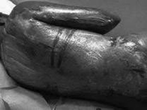 Cặp vợ chồng ác nhân ép người giúp việc ăn bãi nôn, dùng nhà vệ sinh 3 lần/ngày để tiết kiệm nước-2