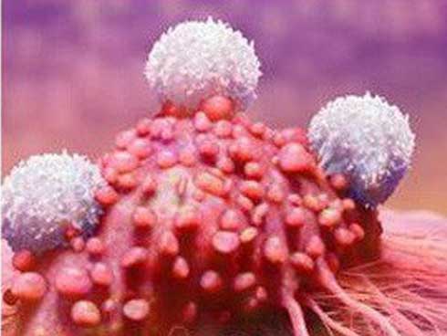 Cả đời không lo ung thư nếu học 8 nguyên tắc ăn uống của bác sĩ nổi tiếng Nhật Bản-6