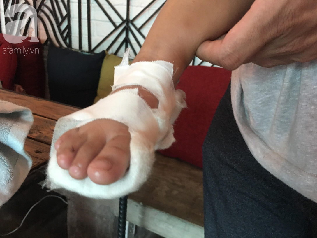 Mẹ bé gái 18 tháng tuổi nghi bị cô giáo tạt nước sôi gây phỏng chân: Đêm nào con bé cũng giật mình khóc ngất-6