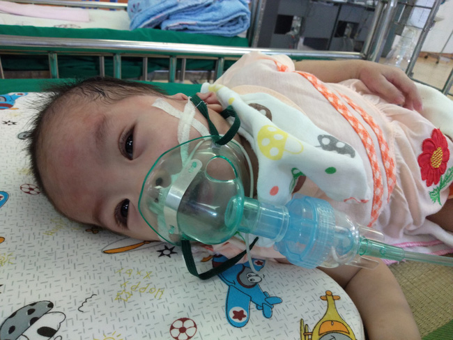 Ánh mắt cầu cứu của bé gái 8 tháng tuổi sống phụ thuộc vào máy thở, chưa một lần được bú sữa mẹ-1