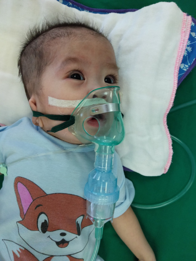 Ánh mắt cầu cứu của bé gái 8 tháng tuổi sống phụ thuộc vào máy thở, chưa một lần được bú sữa mẹ-2