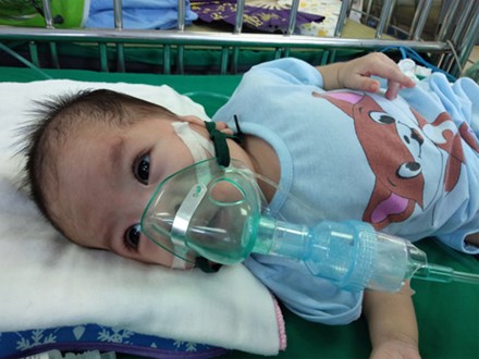 Ánh mắt cầu cứu của bé gái 8 tháng tuổi sống phụ thuộc vào máy thở, chưa một lần được bú sữa mẹ