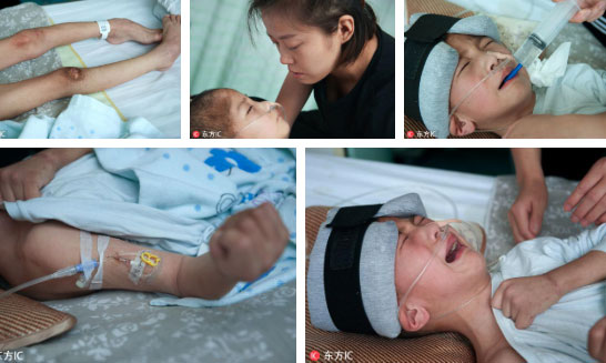 Nhận được điện thoại từ chồng cũ, người mẹ chạy đến bệnh viện và gục ngã khi biết con trai bị bạo hành đến thân tàn ma dại-3