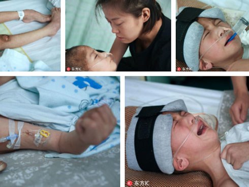 Nhận được điện thoại từ chồng cũ, người mẹ chạy đến bệnh viện và gục ngã khi biết con trai bị bạo hành đến thân tàn ma dại