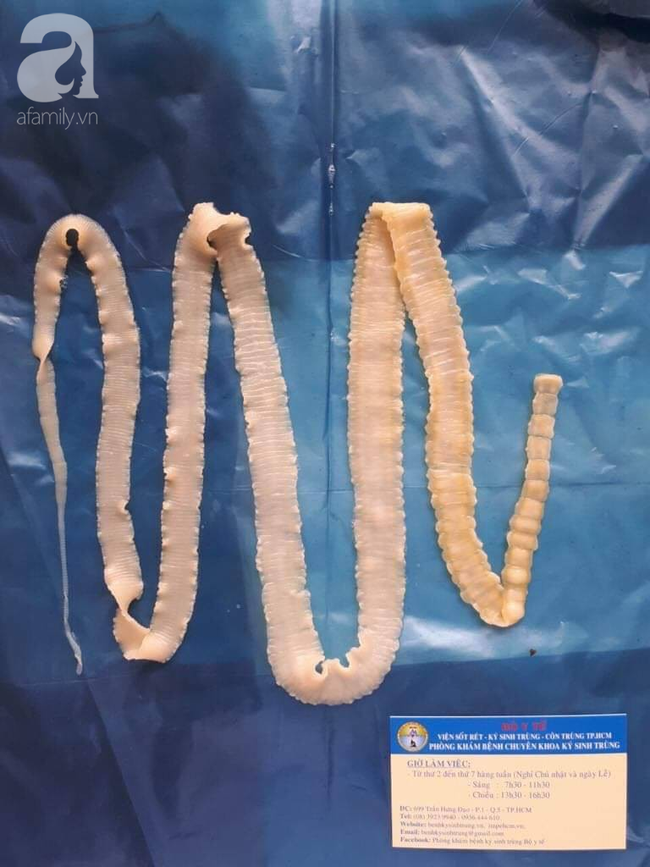 Nguy hiểm: Phát hiện ổ bệnh sán dây lợn, ít nhất 108 người mắc ở Bình Phước nghi do ăn thịt sống-3