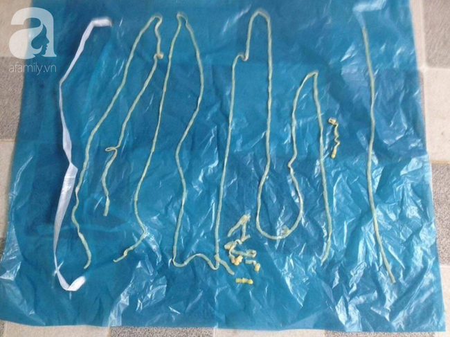 Nguy hiểm: Phát hiện ổ bệnh sán dây lợn, ít nhất 108 người mắc ở Bình Phước nghi do ăn thịt sống-2