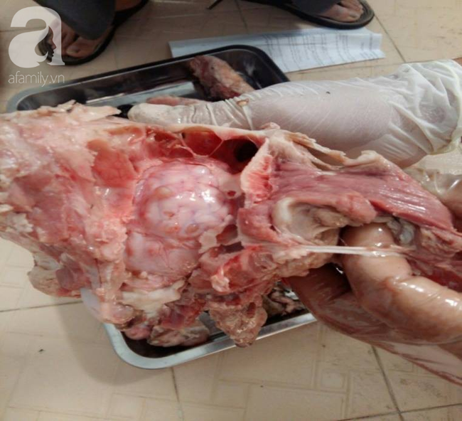 Nguy hiểm: Phát hiện ổ bệnh sán dây lợn, ít nhất 108 người mắc ở Bình Phước nghi do ăn thịt sống-1