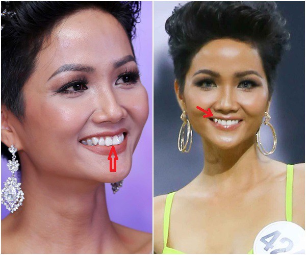 Soi Mai Phương Thuý, H’Hen Niê, Huyền My thay đổi ngoạn mục” khi giã từ răng khểnh-3