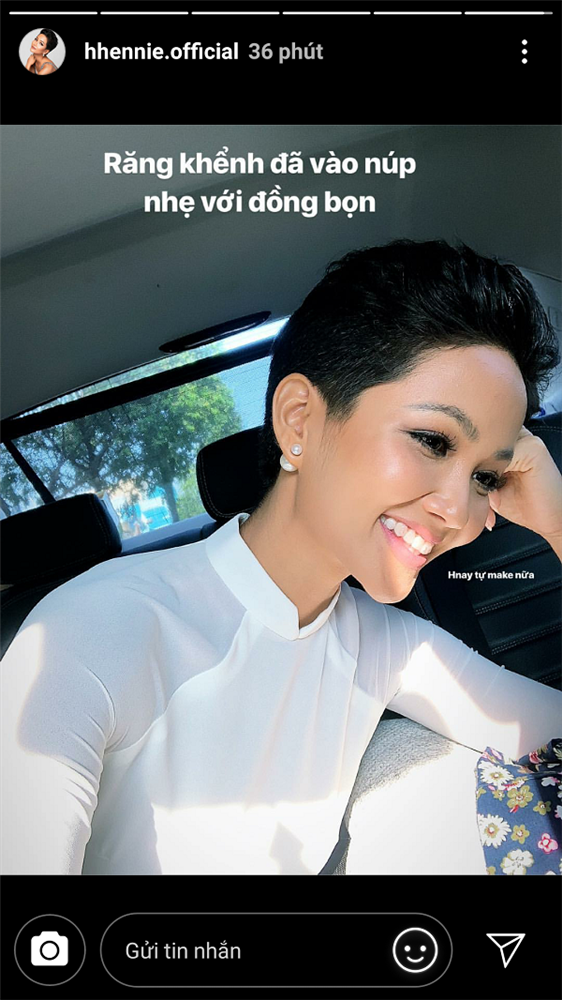 Soi Mai Phương Thuý, H’Hen Niê, Huyền My thay đổi ngoạn mục” khi giã từ răng khểnh-1